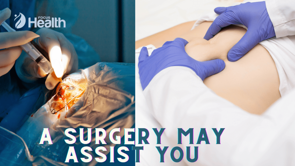 A SURGERY MAY ASSIST YOU